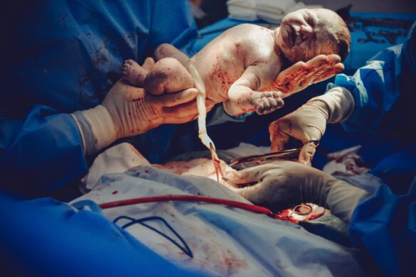 como convertir las uci neonatales en espacios mas humanos