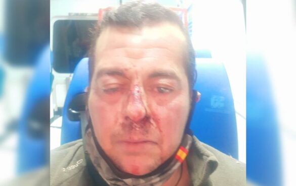 brutal paliza a un hombre trans en toledo a ver si pegas como un chico o como lo que eres una tia