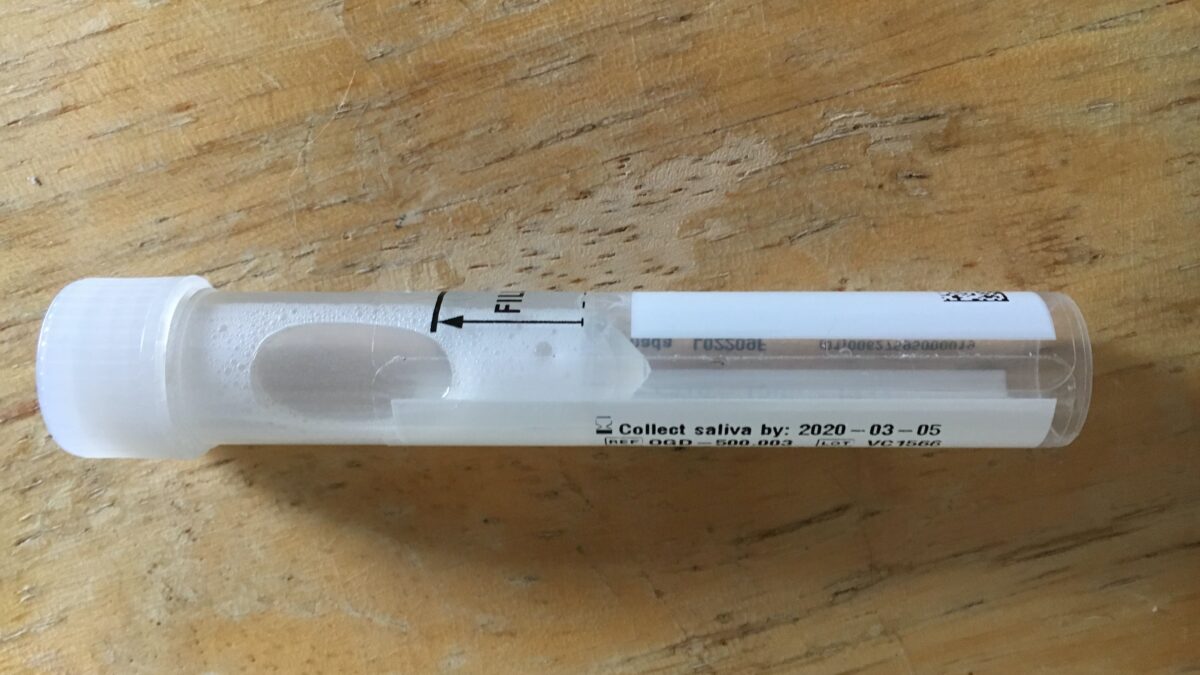 Covid-19: ¿qué son los test de saliva y por lotes, y cuáles son sus ventajas?
