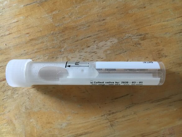 covid 19 que son los test de saliva y por lotes y cuales son sus ventajas