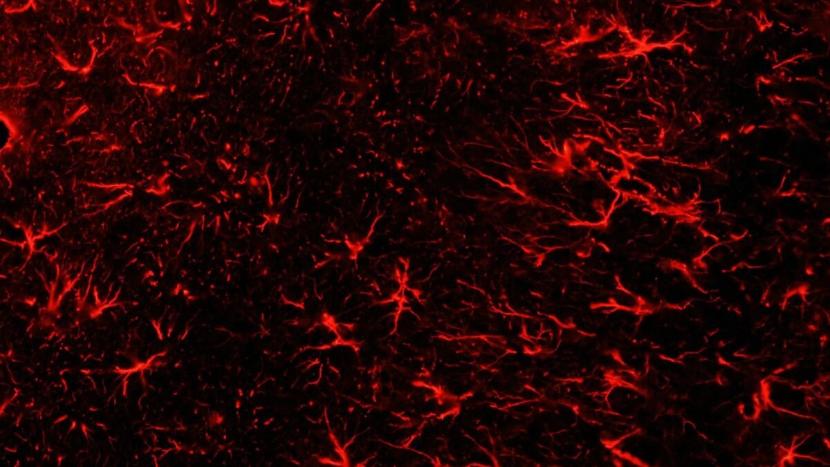 La glía: una pieza más en el puzle de la bipolaridad y la esquizofrenia