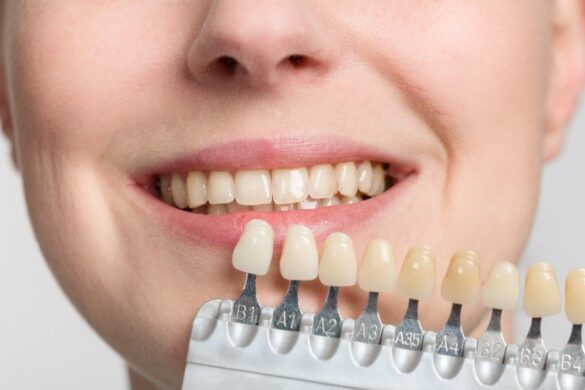 se considera una patologia el cambio de color de los dientes