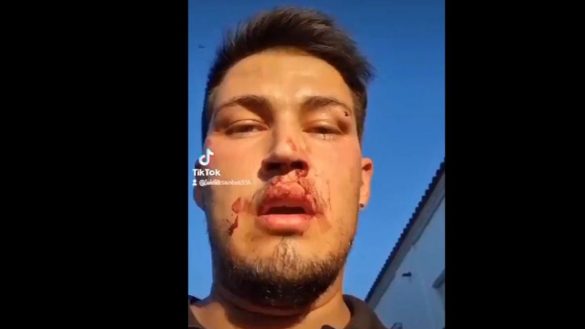 agredido "por maricón"